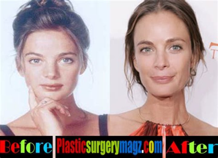 Gabrielle Anwar Plastic Surgery Before and After