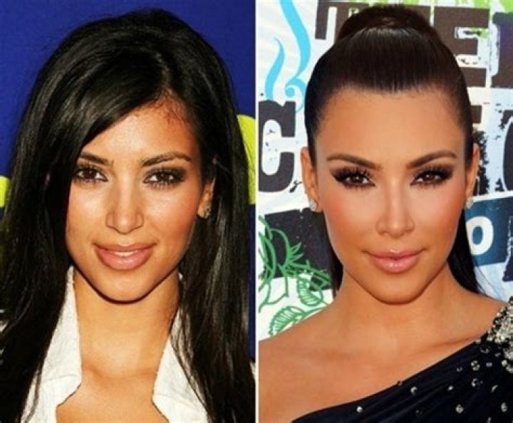 Kim Kardashian, Jennifer Aniston, Meg Ryan – Celebrities Addicted To Plastic Surgery and Fillers